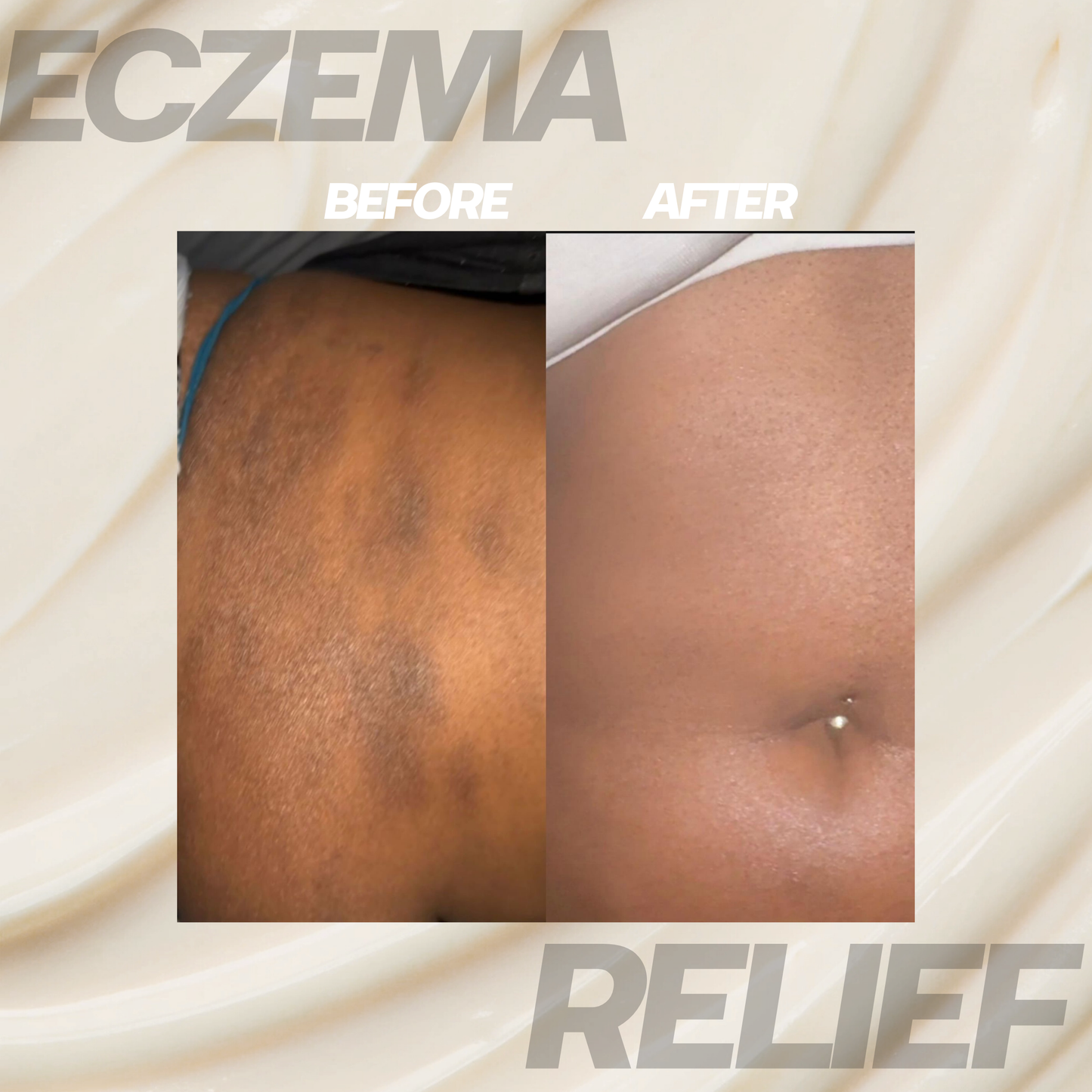 Eczema Relief Kit