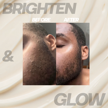 Brighten and glow Kit
